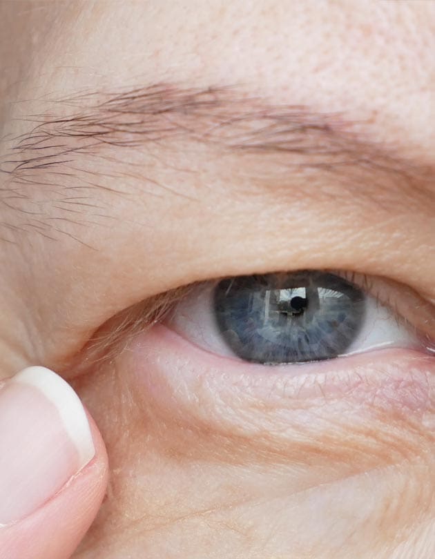 HR Plastic Sugery - Droopy eye brows Common Causes