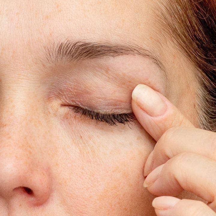 HR Plastic Sugery - Droopy eyelids - Eyelid bags - Loose excess eyelid skin What Can I do