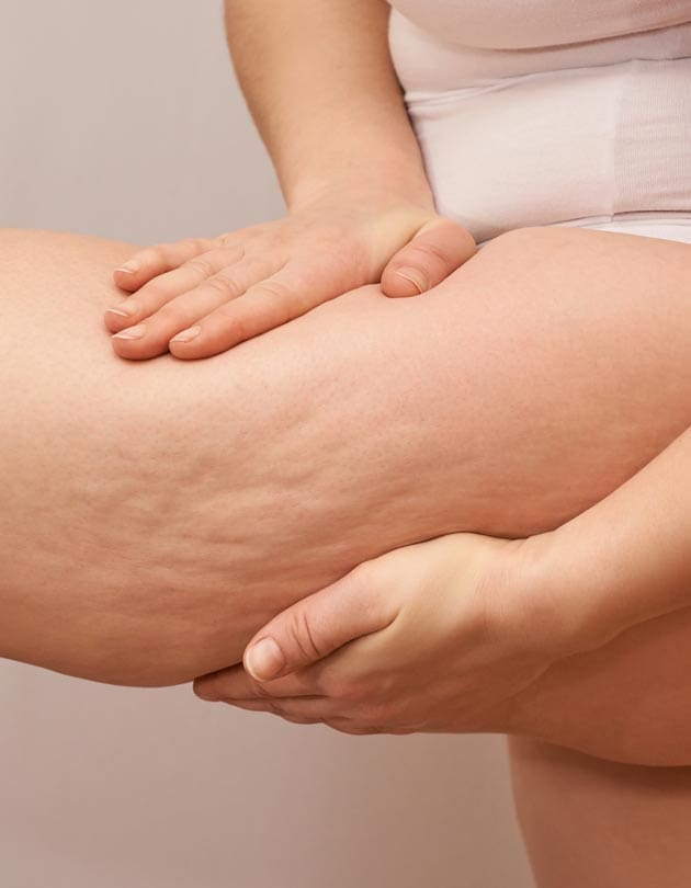 HR Plastic Sugery - Loose excess thigh - leg skin Common Causes
