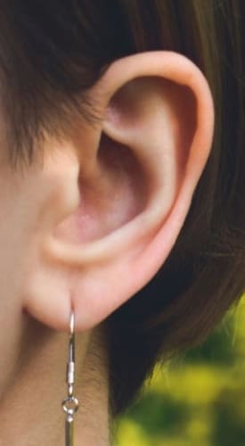 HR Plastic Surgery - Ear Pinning Consultation, Procedure, Recovery