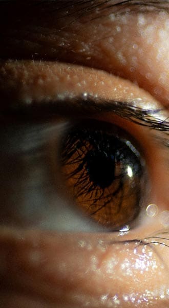 HR Plastic Surgery - Eyelid Surgery (Blepharoplasty) Good Candidate - small
