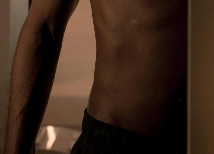 HR Plastic Surgery - Male Abdomen Liposuction What is