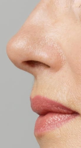 HR Plastic Surgery - Nose Reshaping Causes, Benefits, Risk
