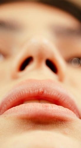 HR Plastic Surgery - Nose Reshaping Good Candidate - small