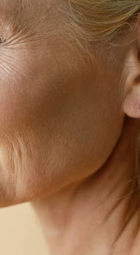 HR Plastic Surgery - Anti-Wrinkle Treatment Causes