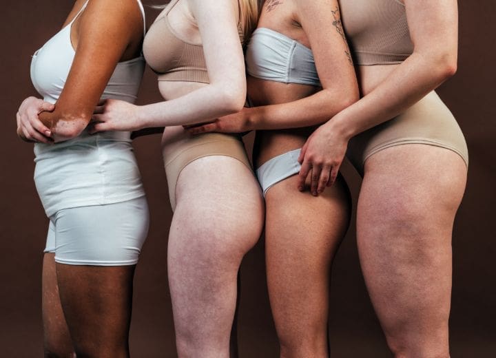 HR Plastic Surgery - Breast & Nipple Variations What Is