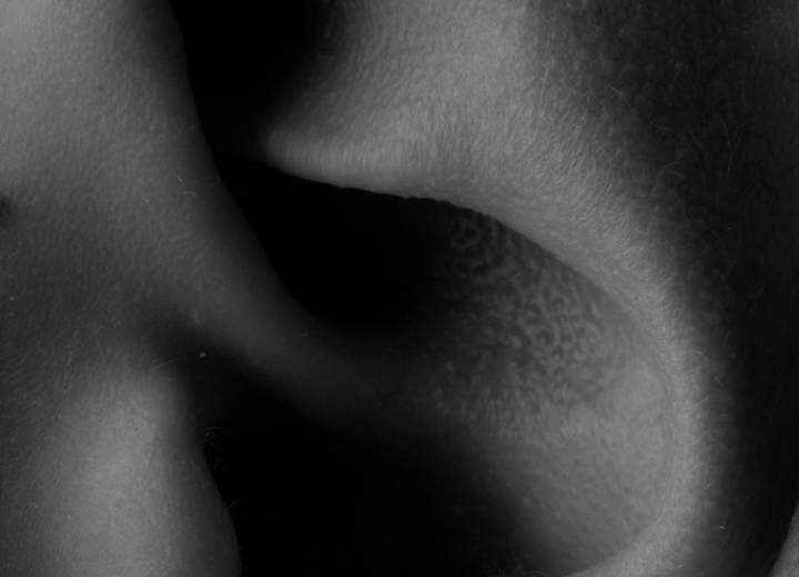 HR Plastic Surgery - Ear Pinning Surgery What Is
