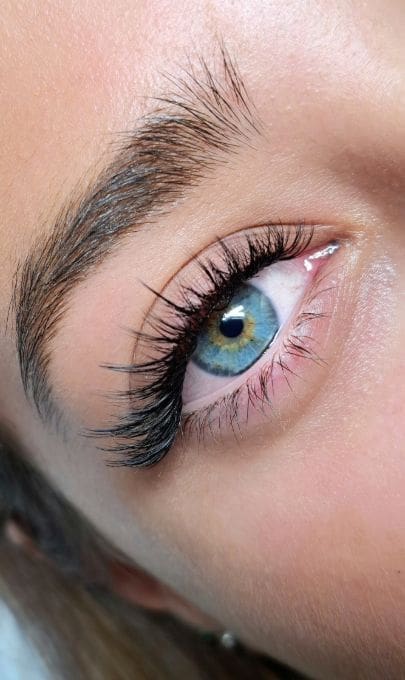 HR Plastic Surgery - Eyelid Reduction Leaflet