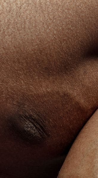 HR Plastic Surgery - Gynaecomastia At A Glance