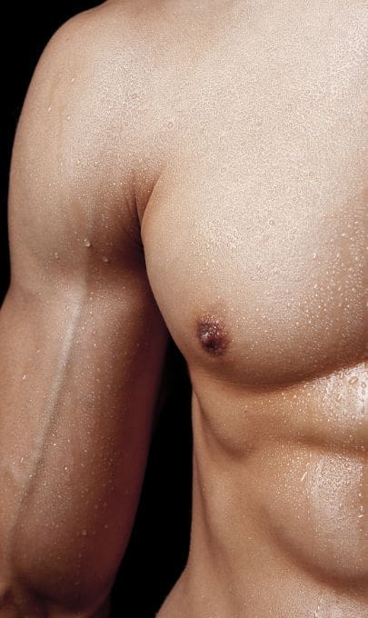 HR Plastic Surgery - Male Breast Reduction Leaflet