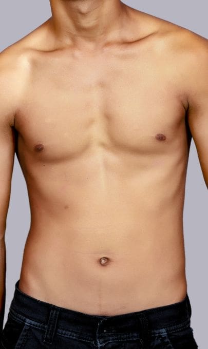 HR Plastic Surgery - Male Breast Reduction Prep For Surgery