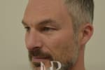 HR Plastic Surgery - Nose Reshaping (Rhinoplasty) patient after 2