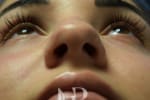 HR Plastic Surgery - Nose Reshaping (Rhinoplasty) patient before 10