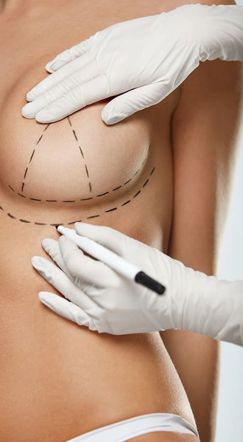 HR Plastic Surgery - GalaFLEX Mesh Internal Bra in Modern Mastopexy