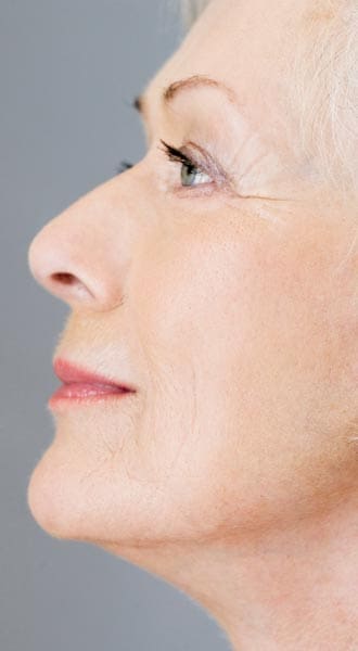 HR Plastic Surgery - Anti Wrinkle Treatment Good Candidate - small